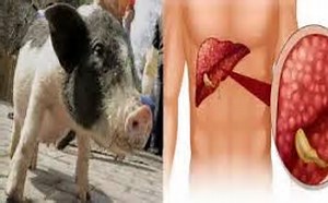 pi liver